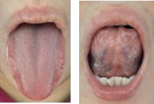 月经崩漏按哪个穴位能止血,月经崩漏止血中药方