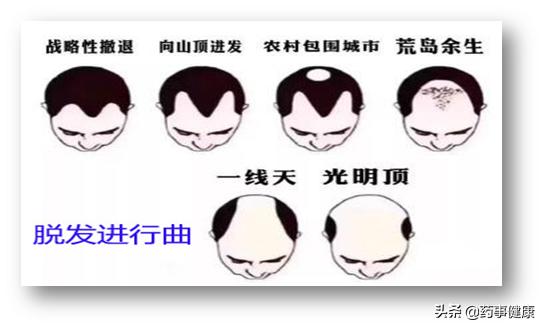 脱发越来越成为中青年人的烦心事，究竟如何摆脱秃顶的烦恼？