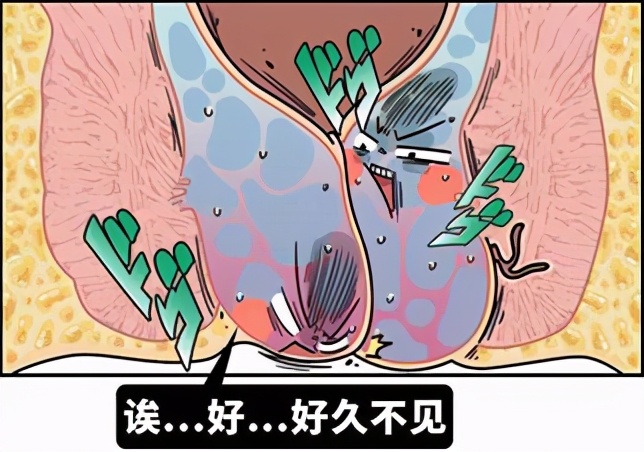 痔疮发展到什么程度了适合手术,痔疮目前国内最先进的手术