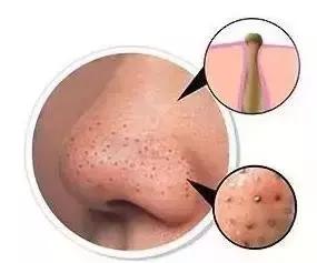 dmc欣兰黑里透白冻膜深层清洁面膜,种草去黑头