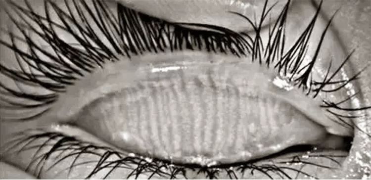 11岁孩子眼睛透支成中老年人,小朋友眼睛过度疲劳的危害