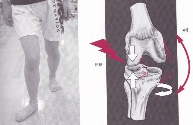 幼猫走路外八字怎么纠正,纠正内八字的训练方法