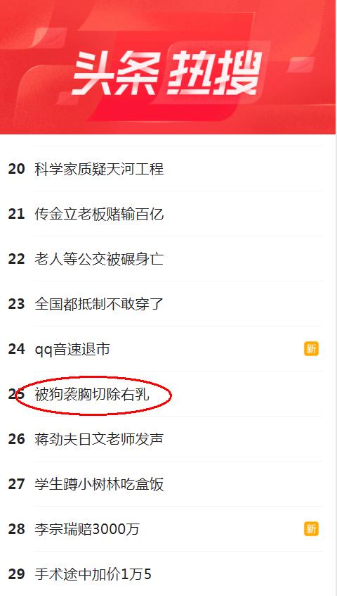 狗狗咬伤女孩后续照片,狗狗咬到人狂犬病