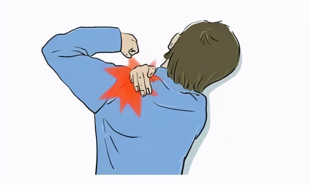 肩背部小针刀视频,颈肩小针刀操作图