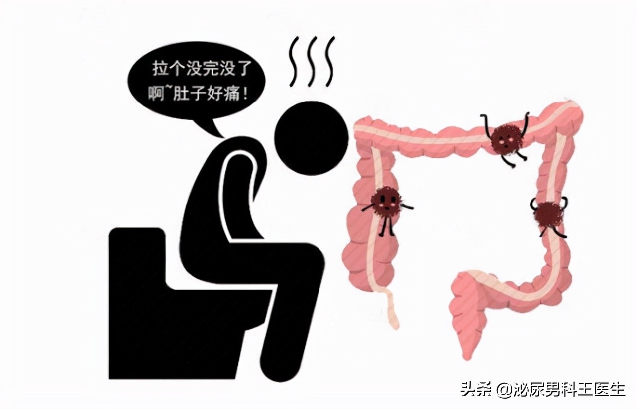 一个人没有直肠怎么办,一个人没有大肠怎么生活