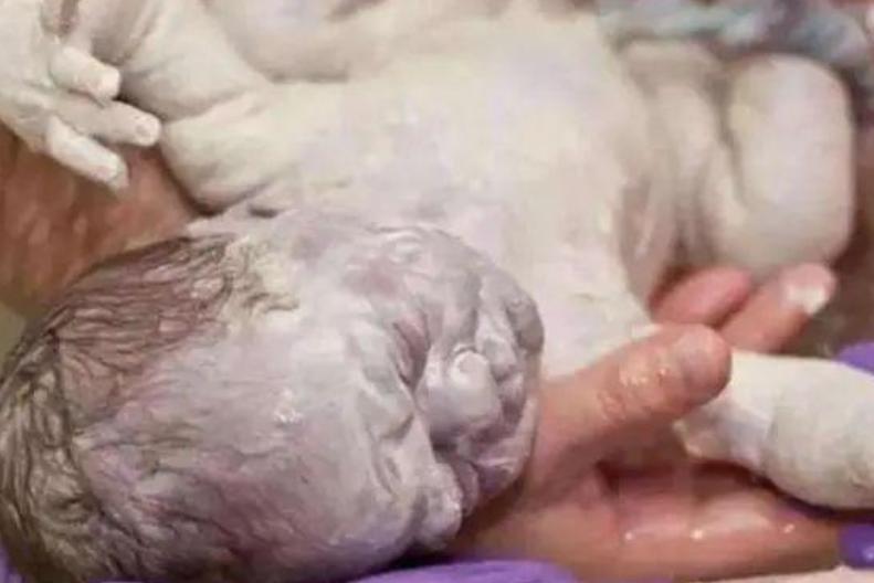 90后宝妈生下3胞胎,90后的宝妈生宝宝