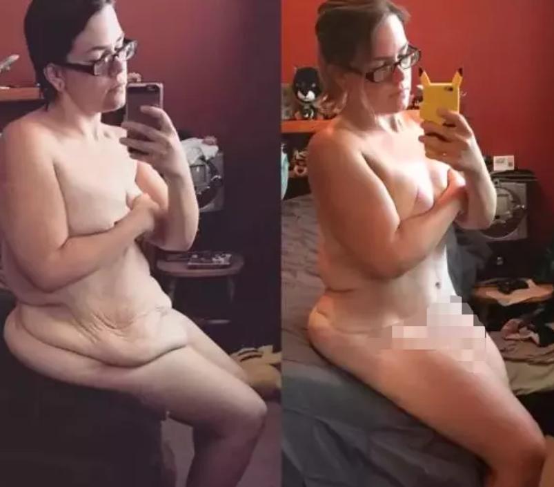 杨天真切胃后瘦了吗,杨天真做切胃手术