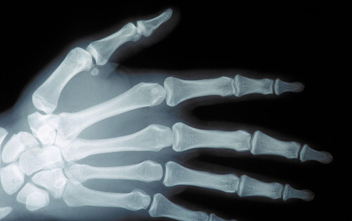 正中神经损伤吃什么食物有助恢复,正中神经损伤的临床表现为