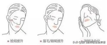 多种皮肤问题怎么办,常见皮肤问题及解决方案