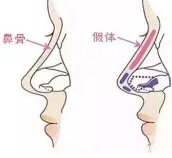 世界第一美人的脸,世界第一丑女整容