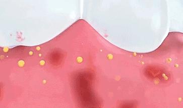 牙黄口臭一招搞定,美白牙齿最有效的方法洗牙