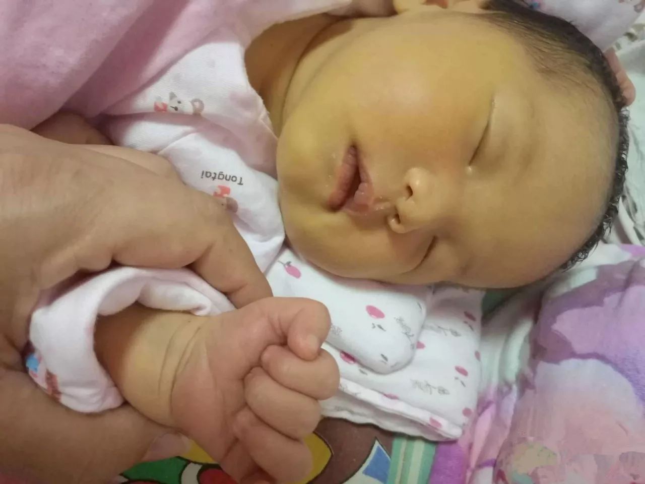 新生婴儿溶血性黄疸怎么照顾,新生儿溶血性黄疸护理月嫂