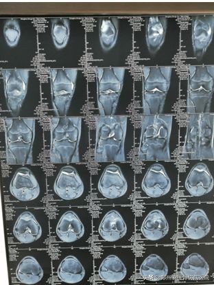 手抬不起来针灸疗法,坐下站不起来针灸穴位