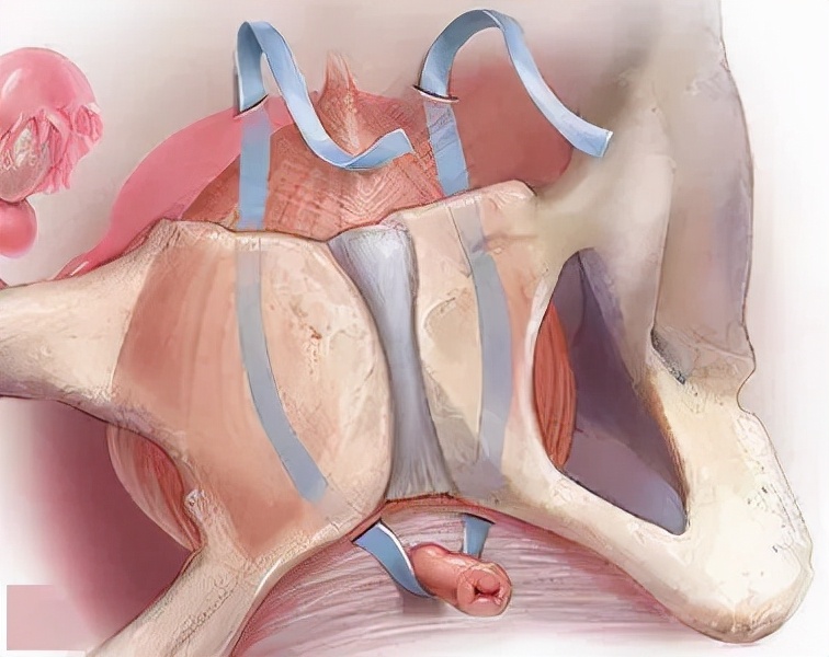 门医动态|好消息！泌尿外科增设女性尿*禁失**专病门诊