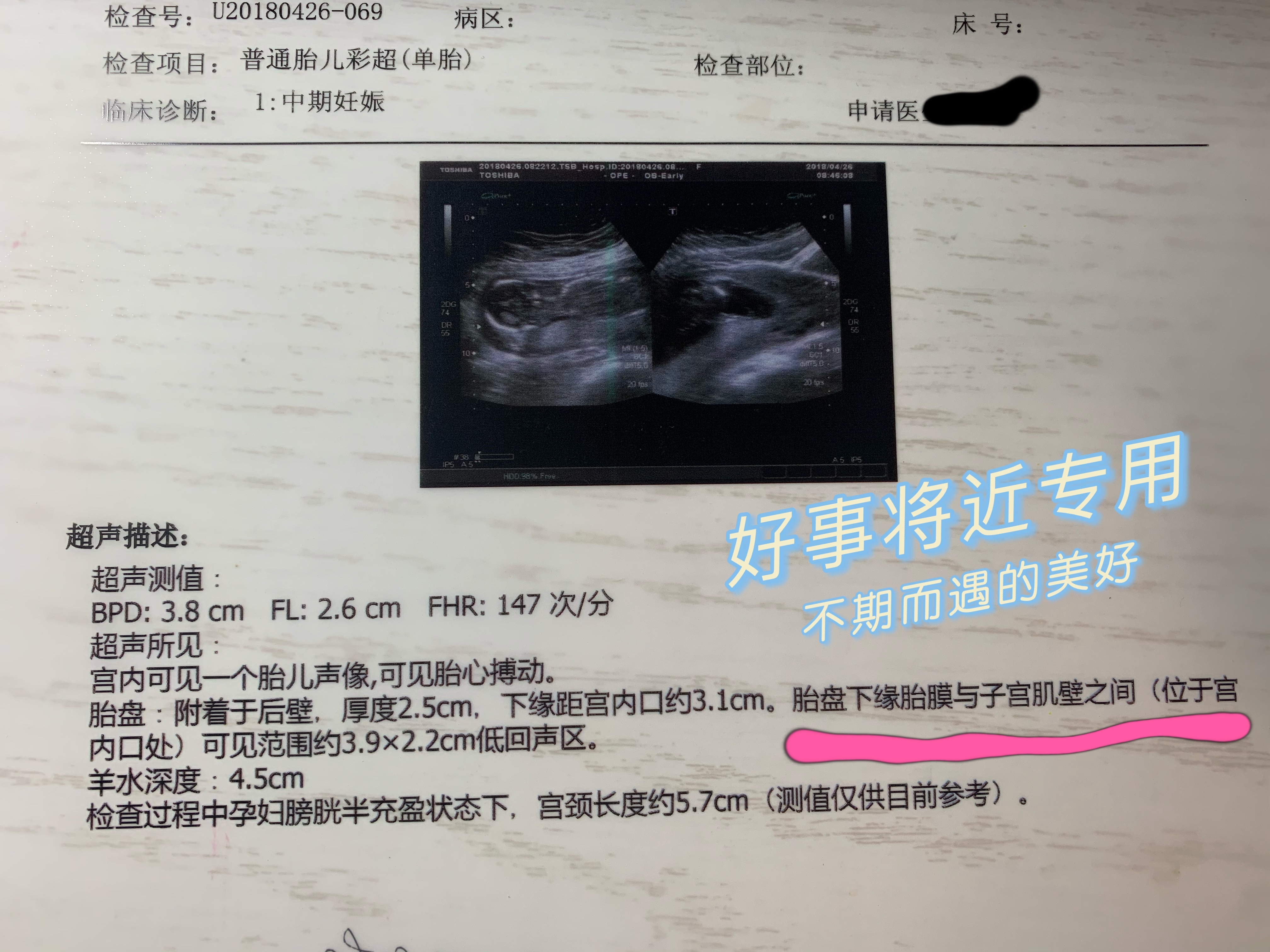 怀孕16周羊水破了见红能否保胎,26周羊水早破保胎成功几率