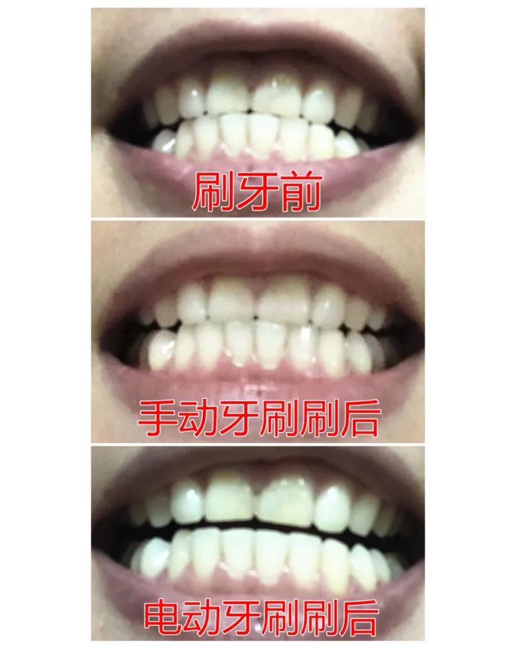 抖音上卖的竹炭牙膏,网红骗局竹炭牙膏是真的吗