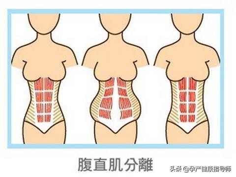 产后恢复迷人身材的方法,产后如何恢复少女感