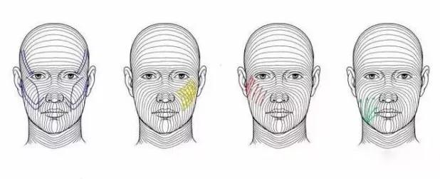 张宗学博士线雕案例分析,张宗学线雕案例
