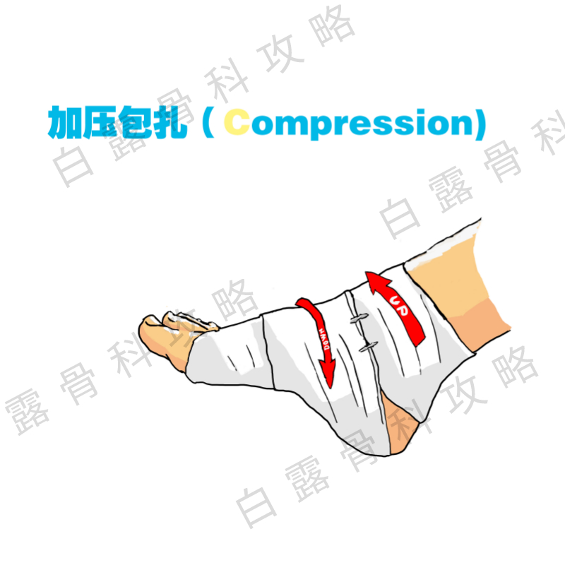 急性踝关节扭伤后的正确处理方法,踝关节扭伤要冰敷几次