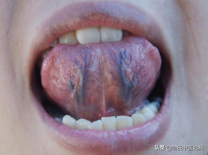 多囊卵泡发育缓慢的原因和治疗,多囊卵泡怎么快速长大