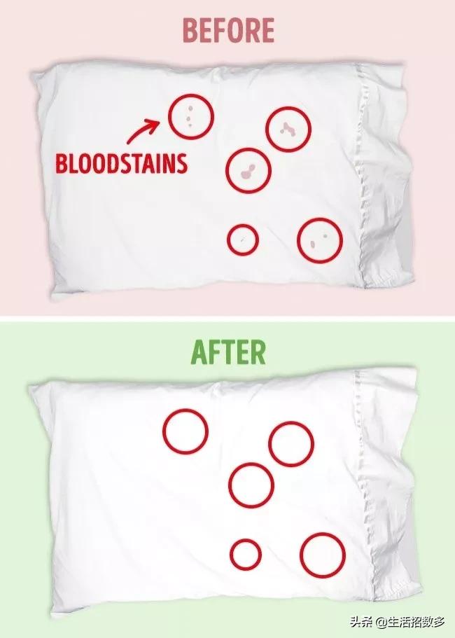 用漂白剂把白色衣服漂黄了怎么办,衣服发黄了用84还是漂白剂