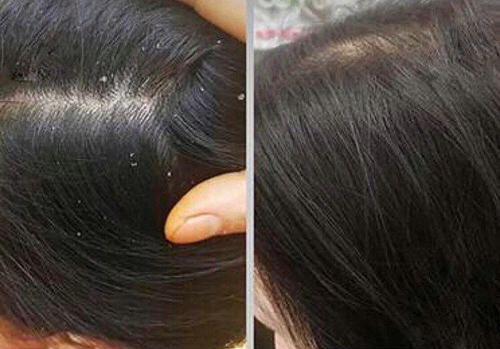 中国口碑最好的洗发水无硅油,洗发水推荐平价学生30元左右