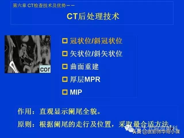 阑尾炎课件,阑尾炎的超声课件