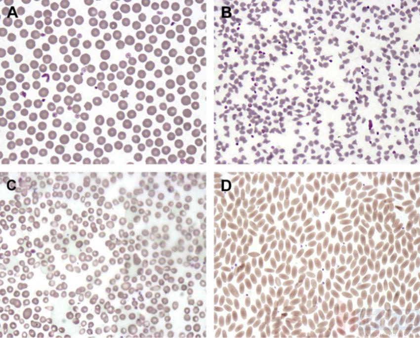 张廷青,张廷青简介
