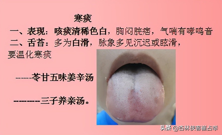 痰在肺则咳痰在胃则呕的意思,肺痰与胃痰