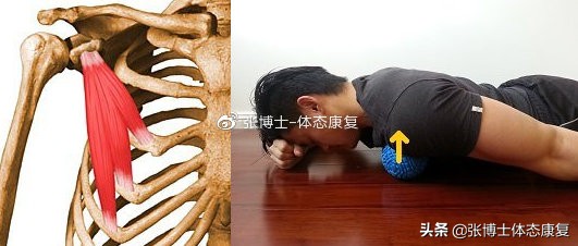 肩胛骨突出矫正的方法,体态矫正脊柱前凸