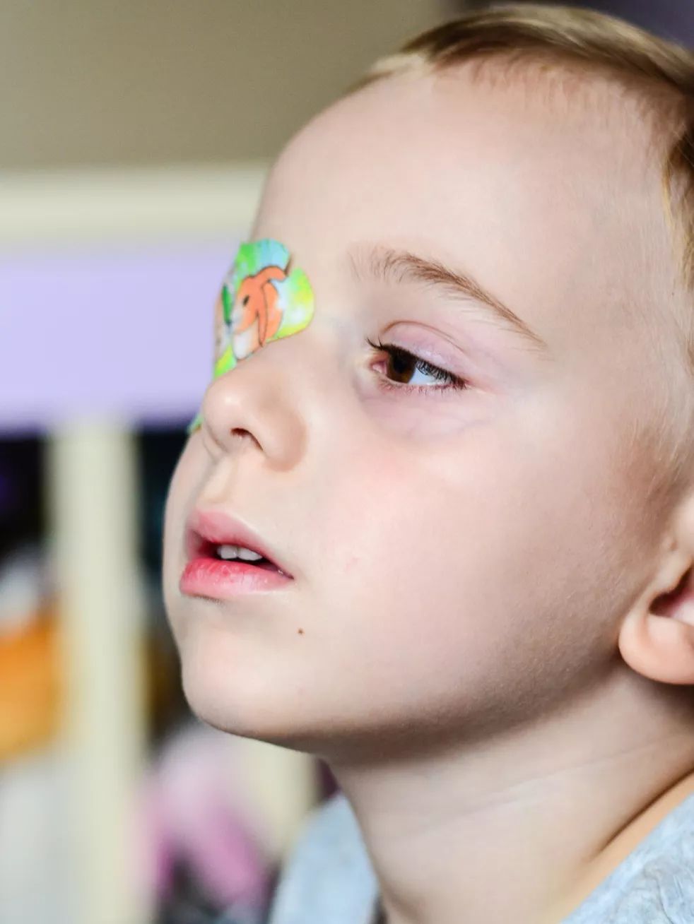 儿童怎样预防弱视,儿童弱视遮盖的正确方法