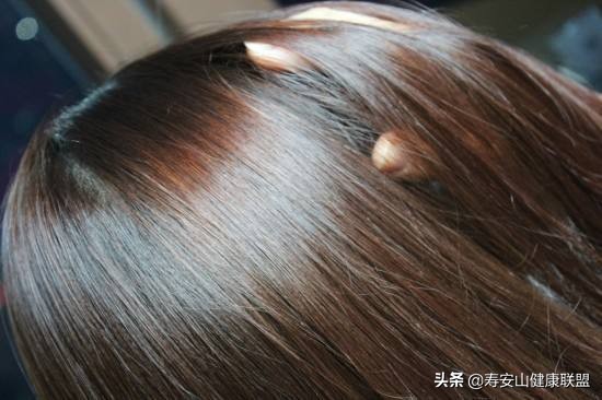 被顽固头屑缠上的四大理由，最后一个你绝对想不到