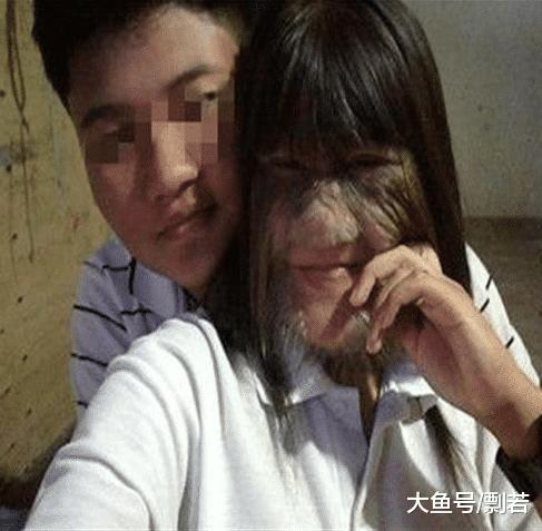 女孩身患“怪病”脸上长毛，男友原本不离不弃，剃发后竟然淡定不了？