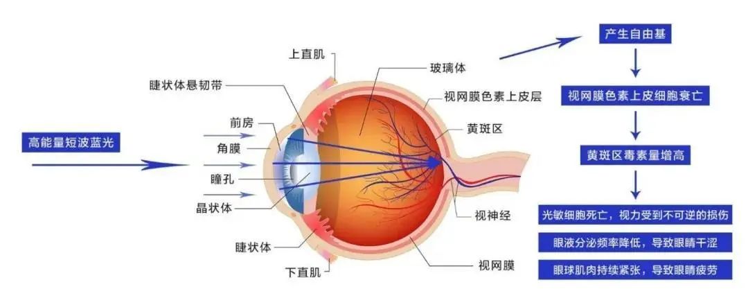 防蓝光眼镜真能护眼吗儿童,防蓝光保护膜真的能保护视力吗