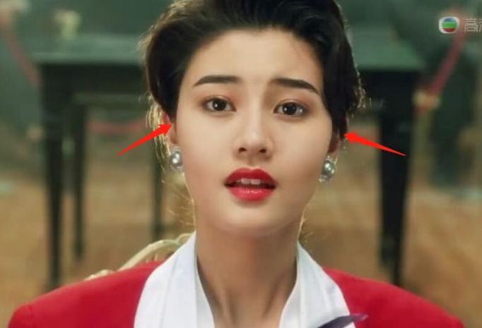 哪个明星做了颧骨内推,颧骨内推明星前后对比