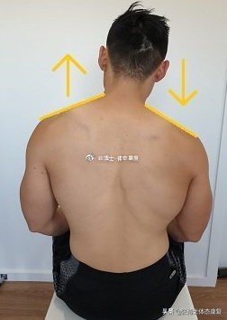 肩胛骨突出矫正的方法,体态矫正脊柱前凸