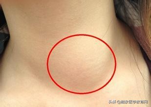 海外针灸,中医针灸真的那么神奇吗