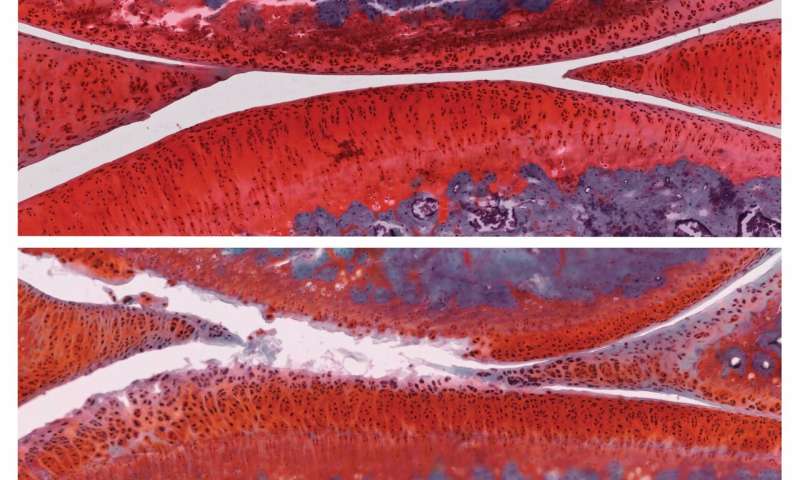 药物控制老年性关节炎,药物联合治疗方案