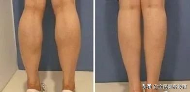 女孩子小腿粗壮如何瘦肌肉腿,小腿肉结实怎样瘦小腿肚