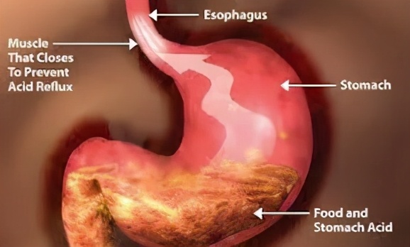 消化不好，百病生，科学提高胃酸13招，解决一半小毛病