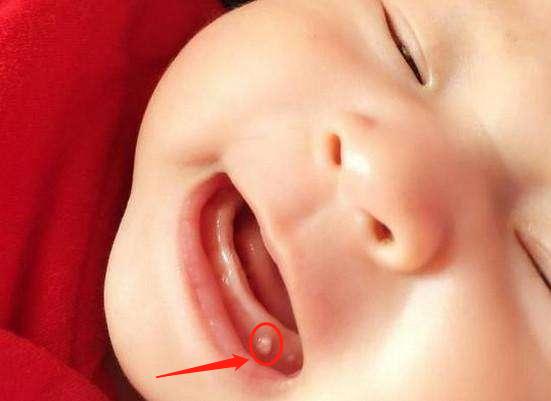 刚出生就来月经？一生下来就“发育”？原来是这原因