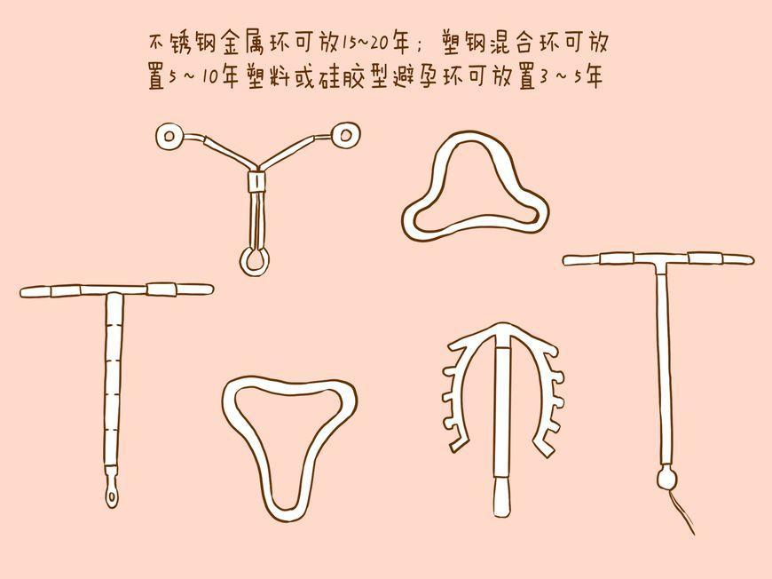 上环后一个月复查需要注意什么,上环取环的相关知识