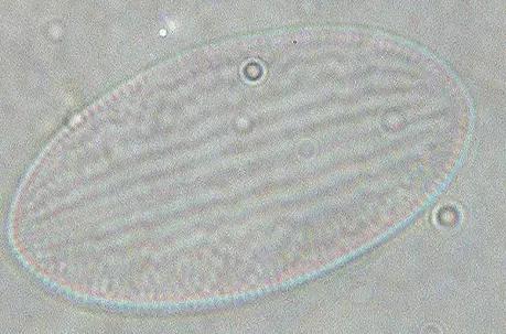 鱼类水产养殖需要哪些藻类,水产养殖显微镜下各种藻类