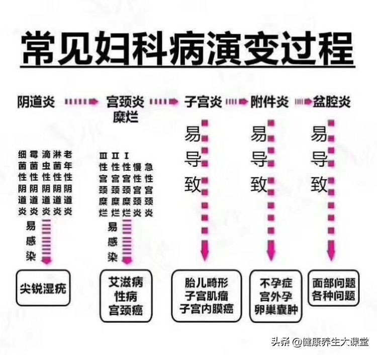 女人有妇科炎症哪些东西不能吃,女人有妇科病一般吃什么药