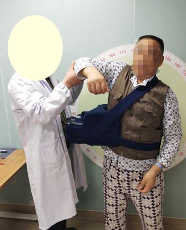 肩袖损伤手术后多长时间完全恢复,肩袖损伤手术后一般多久能恢复