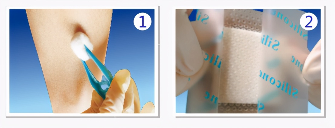 手术伤口愈合后怎么护理好得快,怎么护理伤口的视频