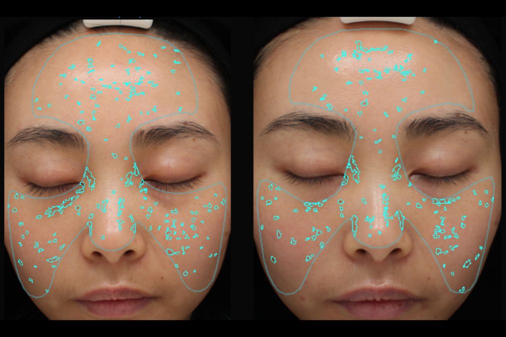 小茂医生美白护肤品,小茂教你如何护肤