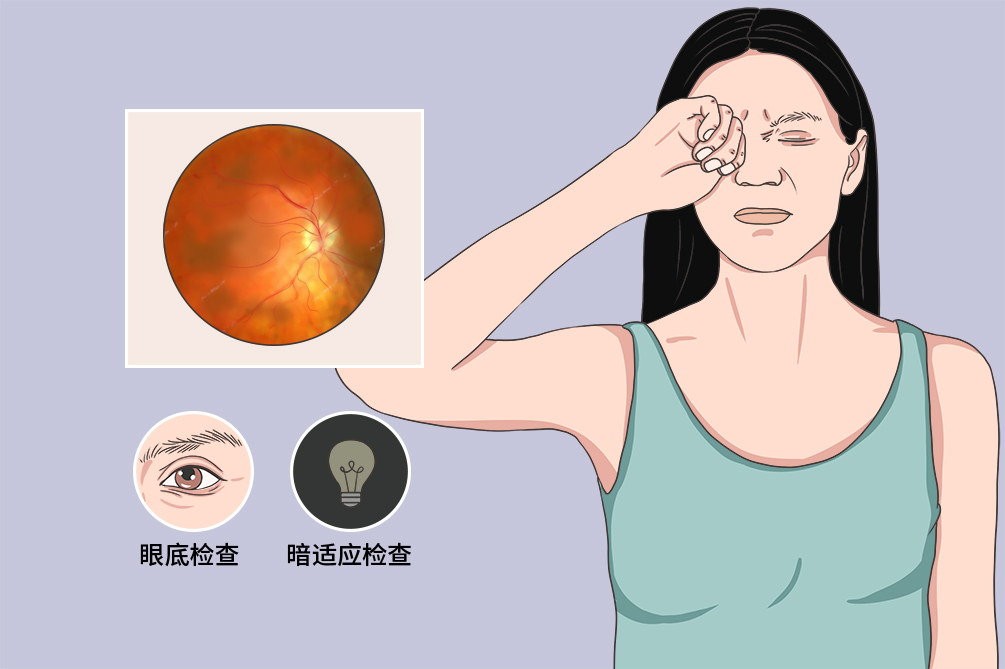 视网膜色素变性夜盲后几年失明,视网膜色素变性一定有夜盲症吗