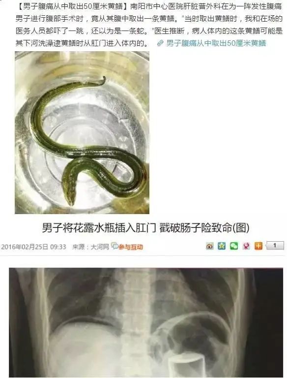 异物进入直肠?先别嫌丢人,赶紧去看医生吧