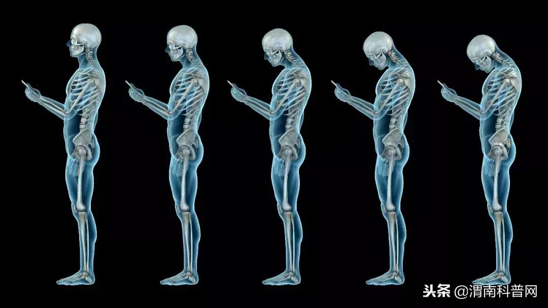 看看吧!这个小动作有可能导致瘫痪!